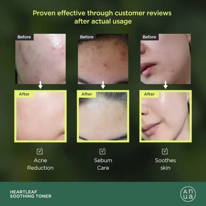 ANUA Heartleaf Toner