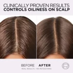 Loreal hyaluronic shampoo